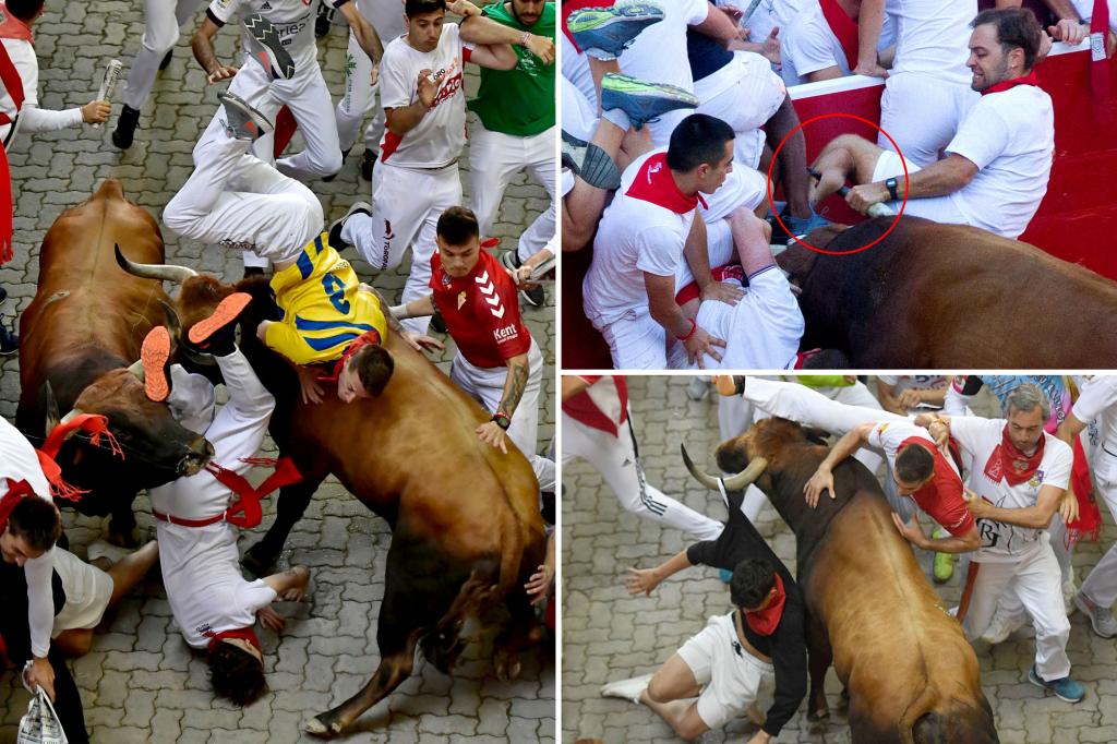 Shocking photos show a Florida man's torn leg in the Pamplona bull run