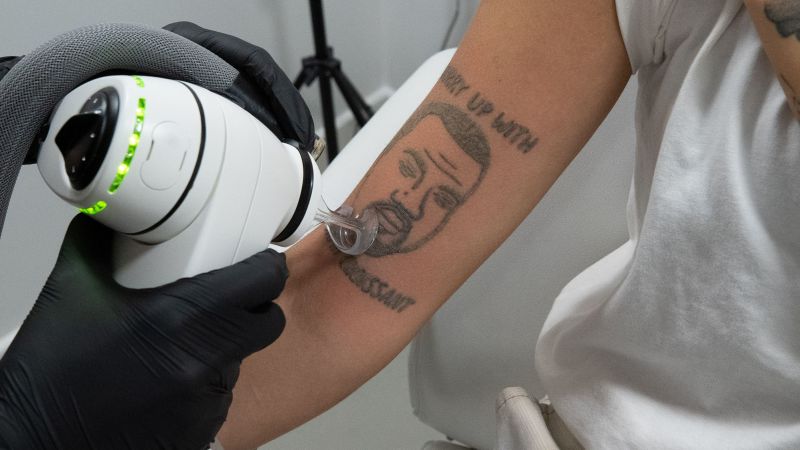 This London tattoo removal studio will still be removing Kanye West's tattoos for free